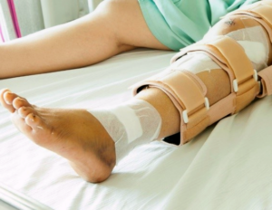 Как помочь пожилому человеку после перелома: советы по уходу